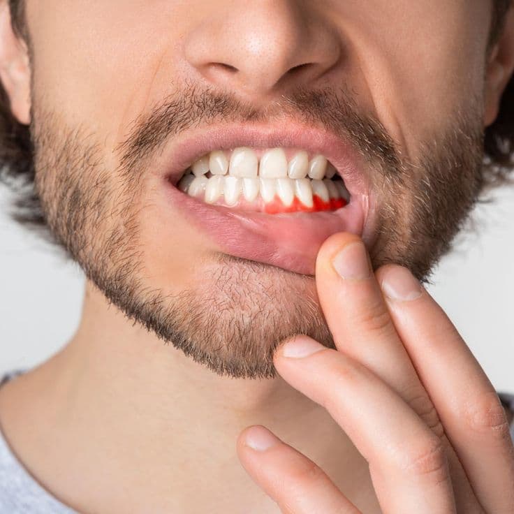 Gum Problems