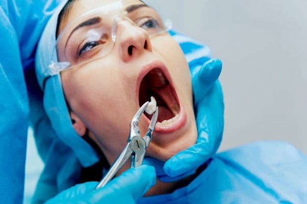 Oral Surgery (Major / Minor)